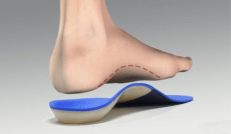 Picture Of Orthotics On A Foot