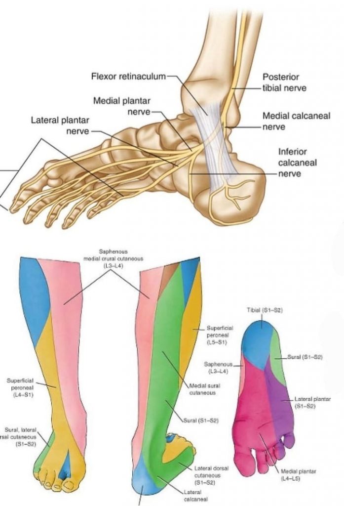 Plantar Fasciitis and Bone Spurs - OrthoInfo - AAOS