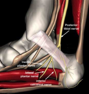 Nerve Entrapments