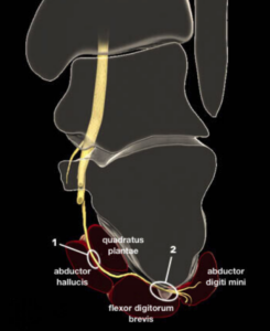 Nerve Entrapments