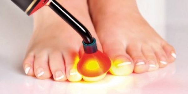 Person with toenail fungus getting PACT therapy