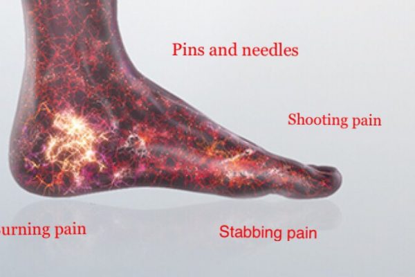common foot conditions